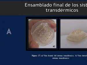 Alumna de la UNAM crea parche para tratar la osteoporosis