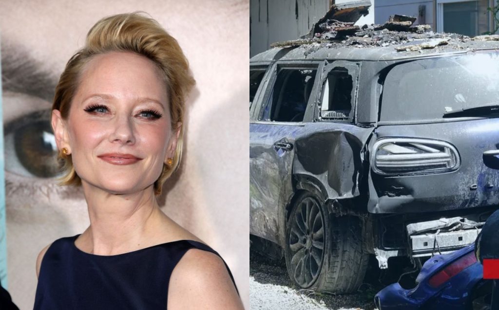 Muere la actriz Anne Heche a causa de graves lesiones por un accidente automovilístico