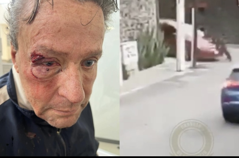 Alfredo Adame es golpeado afuera de su casa durante una riña mortal   