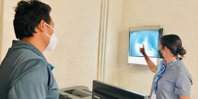 El IMSS Yucatán previene sobre tuberculosis y da recomendaciones para evitar complicaciones