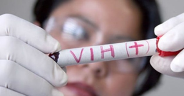 Yucatán se mantiene en el tercer lugar en VIH