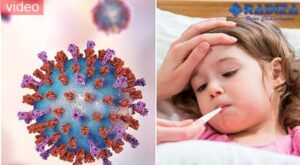 Aviso epidemiológico por VSR en México: Estos son los síntomas del virus sincicial respiratorio