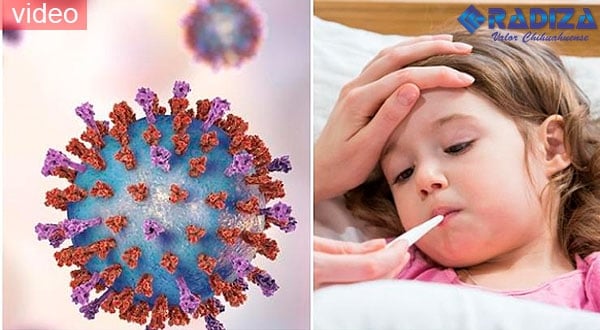 Aviso epidemiológico por VSR en México: Estos son los síntomas del virus sincicial respiratorio